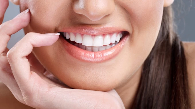 Professional Teeth Whitening in Cape Town